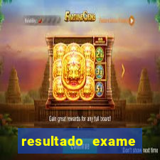 resultado exame eliel figueiredo